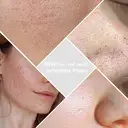 Qiweiny 2-in-1 Mitesser Entferner & Gesichts-Schaber - Tiefenreinigungsgerät mit Akku & Manueller Modus, Porenreiniger für Hautpflege bei Frauen & Männern (Grün) image 6