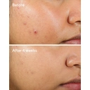 Murad Clarifying Oil Free Water Gel 60 ml image 6