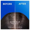 Head & Shoulders Classic Clean 2-in-1 Anti-Dandruff Shampoo Refreshing Scent 250 ml image 2