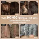 Breo Scalp 3L Laser Hair Growth Comb with 650nm Infrared Technology, 360° Scalp Massager, Waterproof Design, Effective Scalp Stimulation and Hair Regrowth image 5