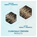 Head & Shoulders DermaXPro Sensitive Care Anti Dandruff Shampoo with Manuka Honey 300ml image 3