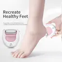 K·SKIN Electric Foot Grinder Callus Remover – Rechargeable Portable Pedicure Tool for Foot Care, Dead Skin & Callus Removal, with Grinding Head & USB Charging Cable, KD300 New Year Sale | Top gift picks image 1