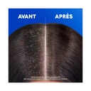 HEAD & SHOULDERS - Shampoing 2en1 Sensitive - 300ml image 6