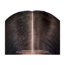 HEAD & SHOULDERS Citrus - Shampooing Antipelliculaire - 1L image 3