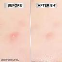 Garnier 8H Invisible Blemish Patches for Spots - 22 patches image 3