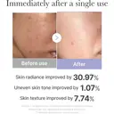 Medicube Age-R Mini Booster Pro Pink – Hautpflegegerät für das Gesicht für den Heimgebrauch image 6
